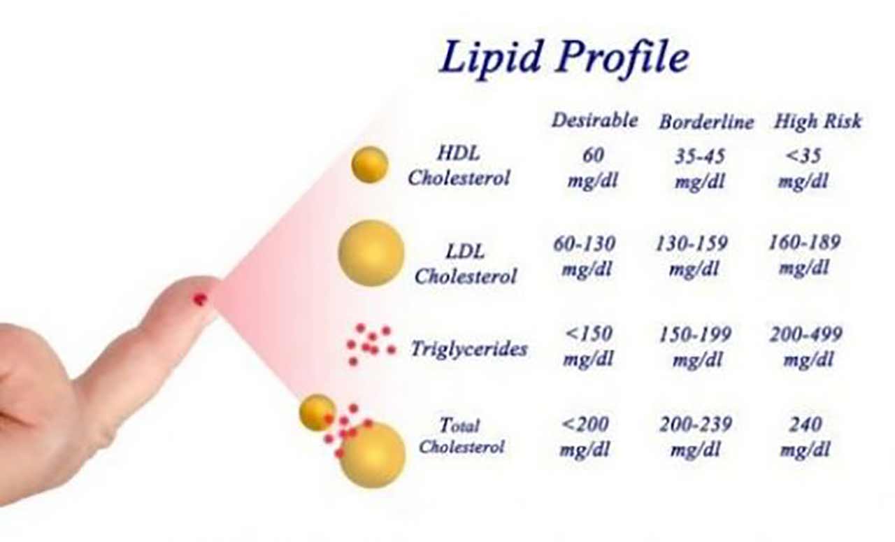 Cholesterol Levels Ldl Hdl Triglycerides at Patrick Treadaway blog